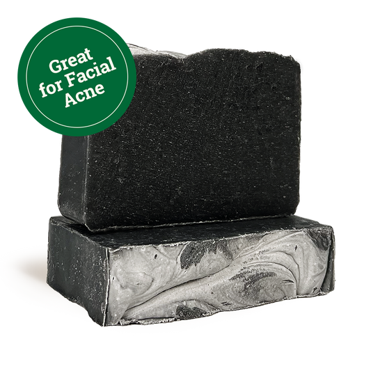 Activated Charcoal Bar